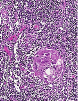 <p>DESCRIBE ESTA IMÁGEN Y EN QUE PARTE SE ENCUENTRAN LOS LINFOCITOS T</p>