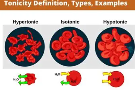 <p><span style="font-family: "Open Sans", sans-serif; line-height: 115%;"><strong><span>Tonicity</span></strong></span></p>