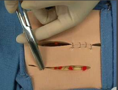 <p>Used to cut suture and supplies. Also known as: Suture scissors.</p>