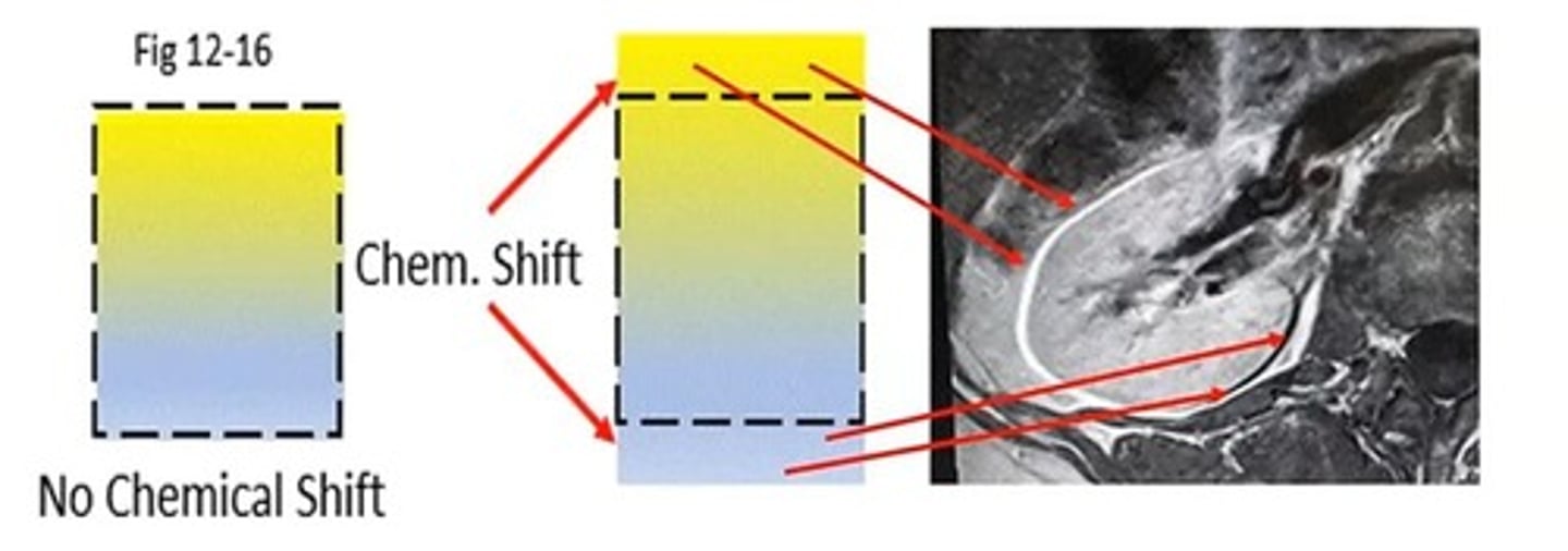 <p>Spin-Spin relaxation or True T2.</p>
