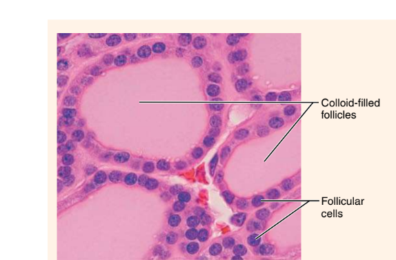 <p>What endocrine organ or gland is this?</p>