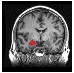 <p>Amygdala - Fear, Focus and Reward</p>