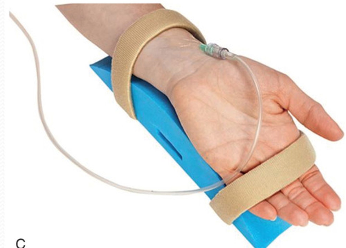 <p>-allows continuous blood pressure measurement and sampling of arterial blood (MAP - mean arterial pressure and ABGs - arterial blood gases)</p><p>-usually placed radial or femoral</p>
