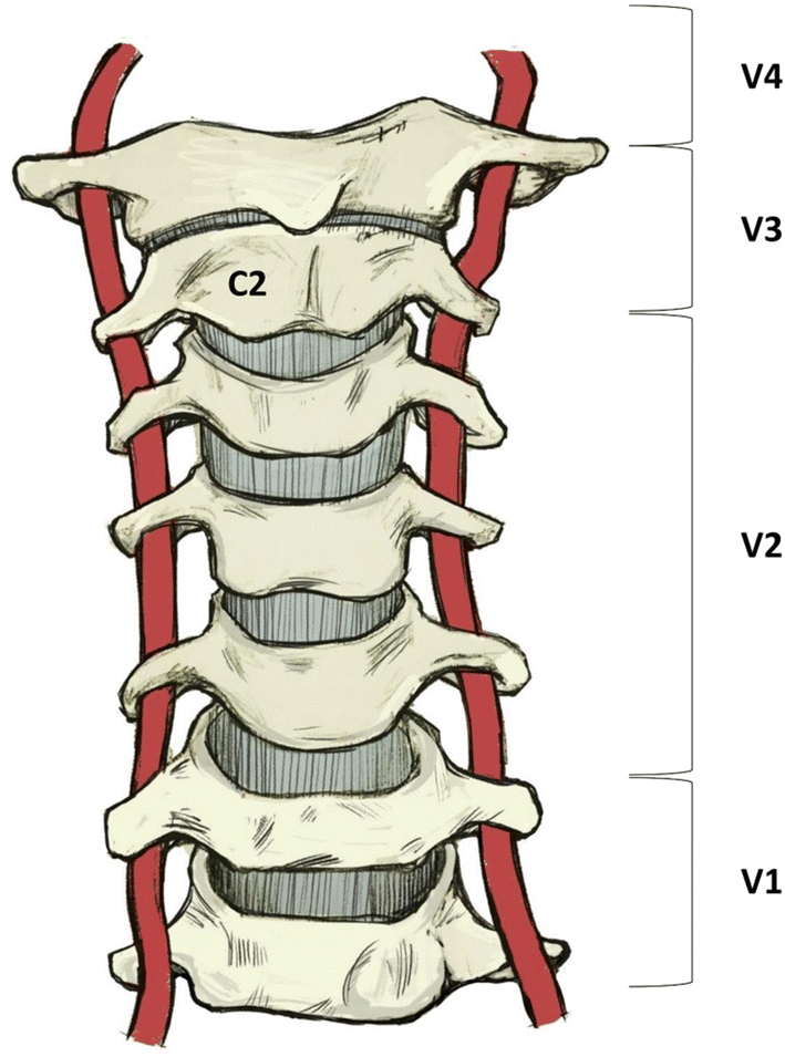 <p>ĐM đốt sống (vertebral artery)</p><ul><li><p>Qua lỗ ngang đốt sống (transverse foramen)</p></li></ul><p></p>