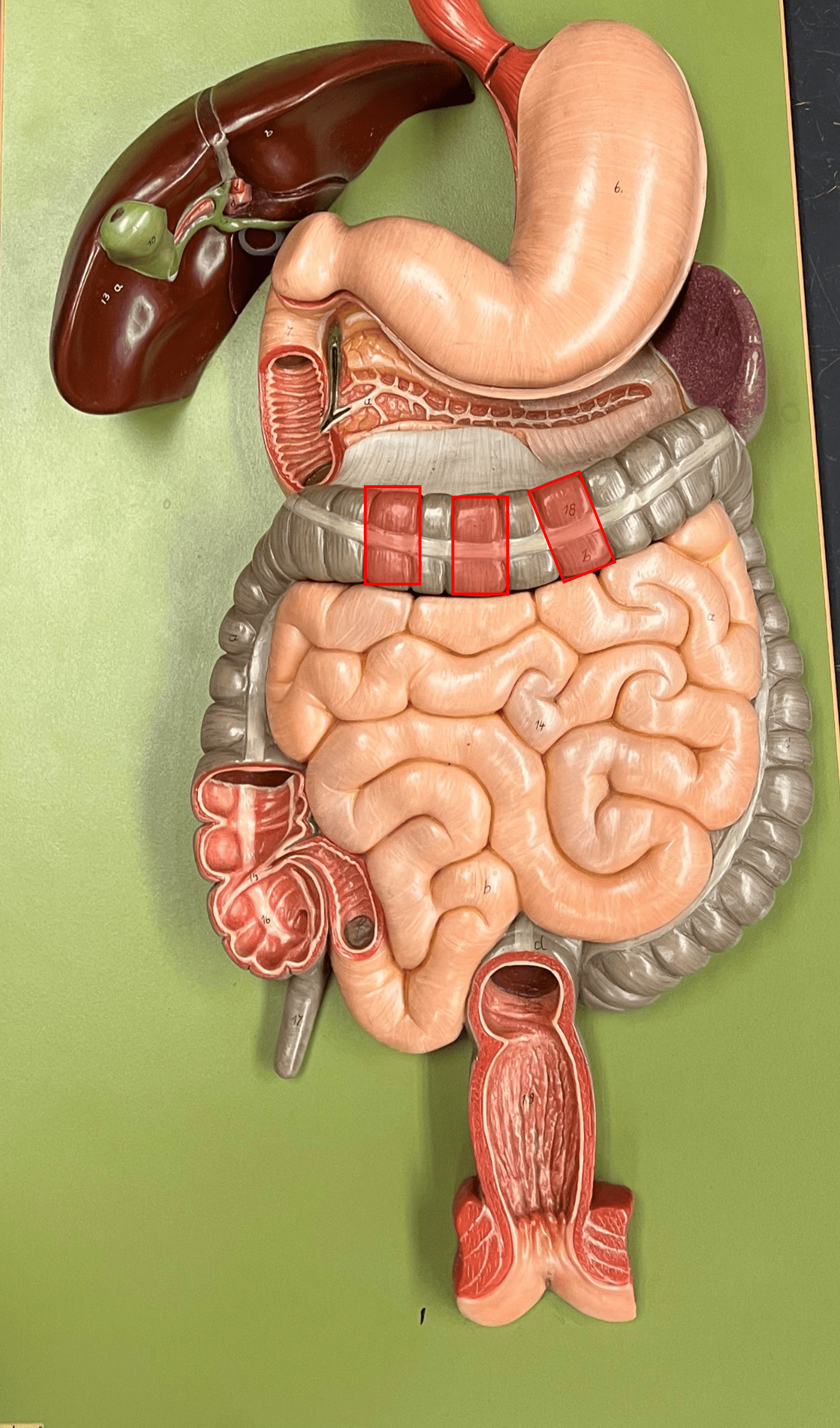 • Pouches of the colon formed by the taenia coli.

• Present on the ascending, transverse, descending, and sigmoid colon.
