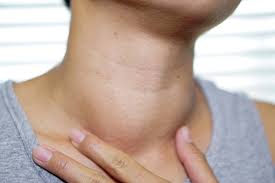 <p>Neck </p>