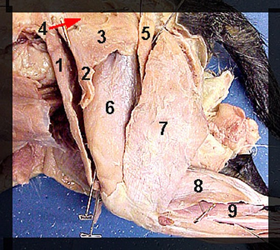 <p>What is the muscle indicated by number 5? What is an attachment point and function?</p>