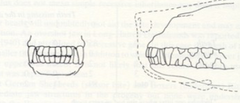 <p>What kind of bite does this mesaticephalic dog have?</p>