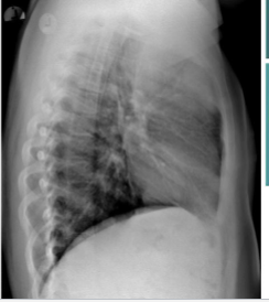 <p>what is this? and what causes it</p>