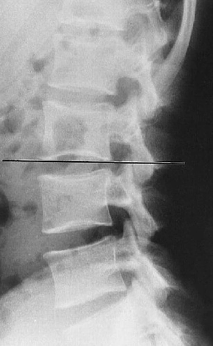 <p>What line of mensuration is this?</p>