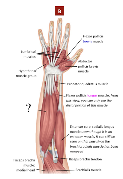 <p>intermediate anterior forearm flexor muscle, has 4 tendons attached from the 2nd to 5th fingers </p><ul><li><p>flexes the wrists, knuckles, and fingers EXCEPT the thumb</p></li></ul><p></p>