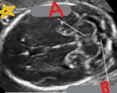 <p>What is labeled as A?</p>
