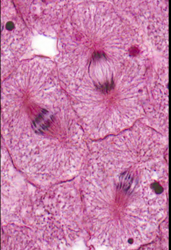 <p>Anaphase</p>