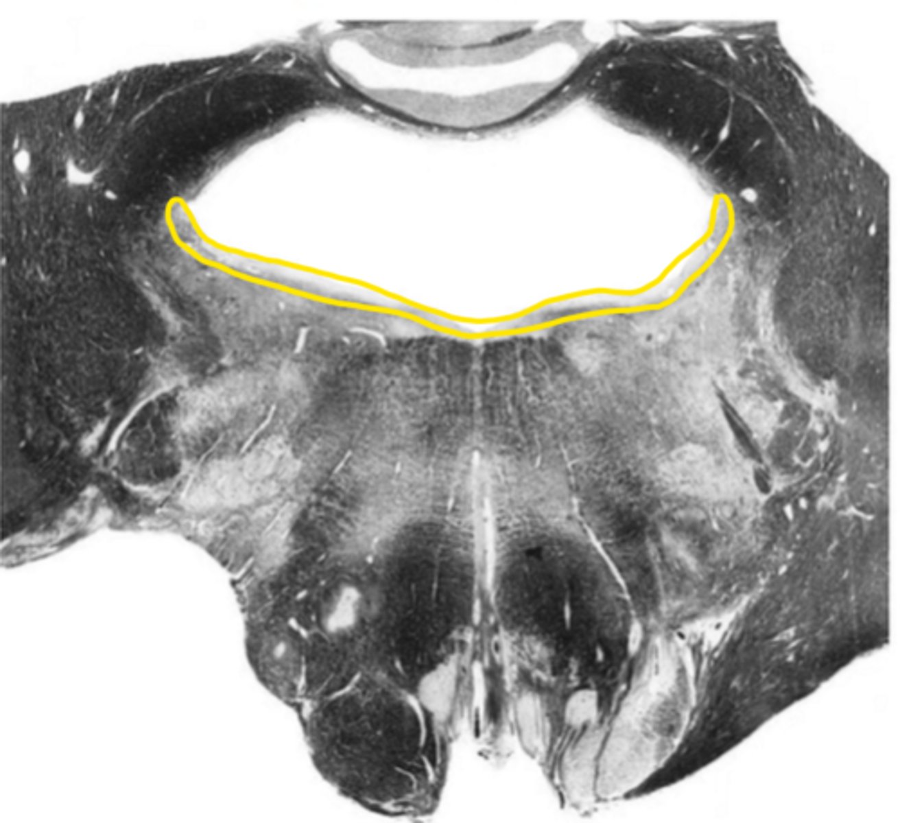 <p>ID the structure</p>