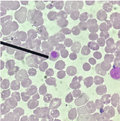 <p>What is the name of this cell as an interference in the manual WBC count procedure?</p>