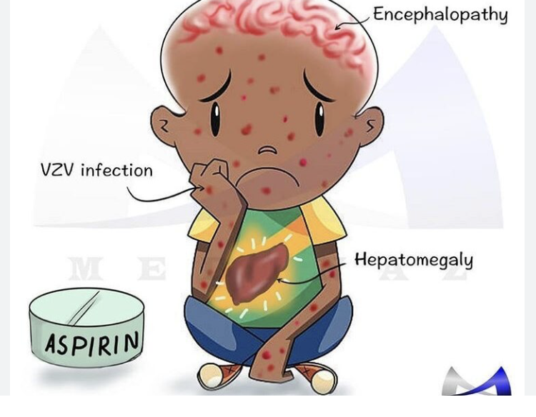 <p>Reye Syndrome </p>