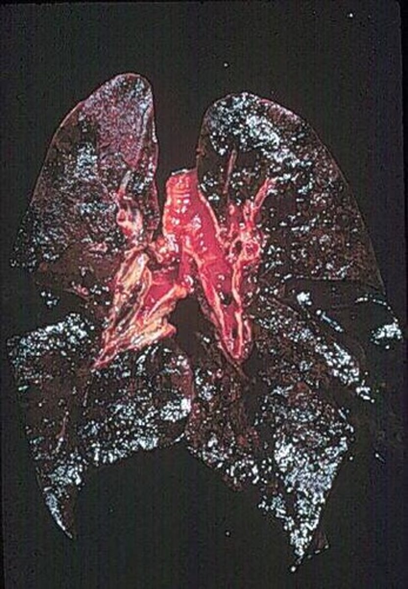 <p>a <b>thick, sticky, dark fluid</b> produced when tobacco burns<br>- a <b>carcinogen</b> <br>- turns lungs black <br>- can <b>develop Bronchitis</b><br>- breaks down alveoli structures<br>- causes breathlessness: lung cancer</p>