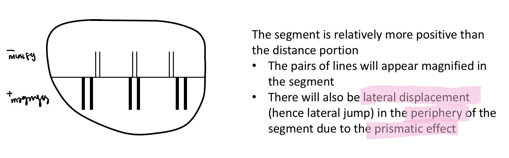 <p>Horizontal displacement of the image when moving between the distance portion and near segment </p><p>Most apparent with a high add and a large segmenr </p>