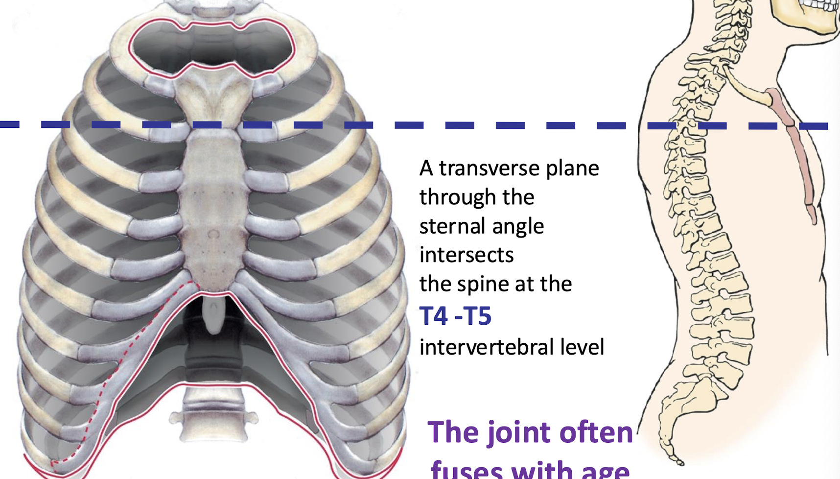 <p>firbocartilagional joint. (bones held together by cartilage)</p><p>Ridge between manubrium and body at second rib (Palpable); in line with spine at T4-T5 vertebrae</p>