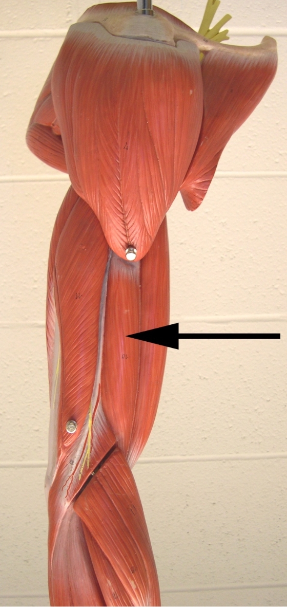 <p>Name the muscle indicated by the arrow</p><p>View: lateral side of the brachial region (upper limb)</p>