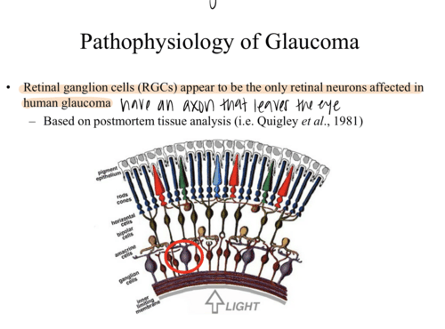 <p>_____ are the only cell that is affected in human glaucoma</p>