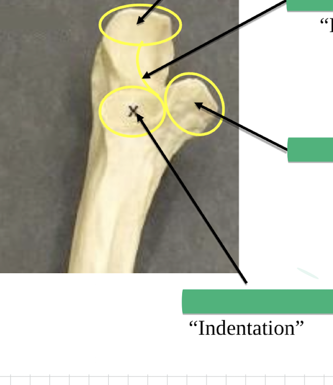 <p>Name this indentation </p>