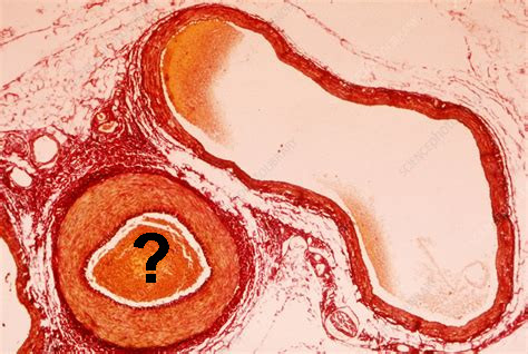 <p>Is this a vein or an artery?</p>