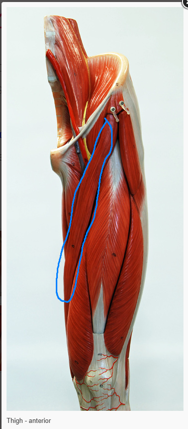 <p>What is the name of the muscle circled </p>