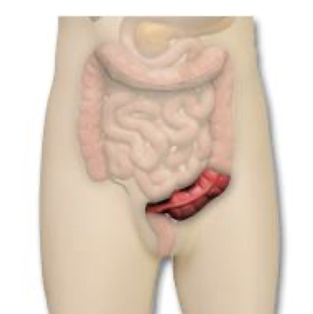 <p>Sigmoid Colon and Rectum:</p><ul><li><p>What structures are considered the LAST section of the Large Intestine?</p></li><li><p>What structures is the Sigmoid Colon and Rectum POSTERIOR to in:</p><ul><li><p>Men:</p></li><li><p>Women:</p></li></ul></li></ul><p></p>