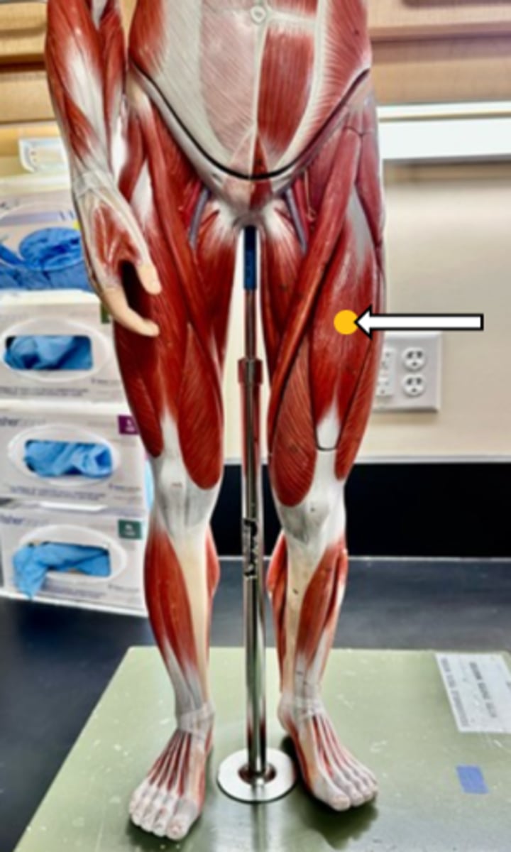 <p>rectus femoris (function)</p>