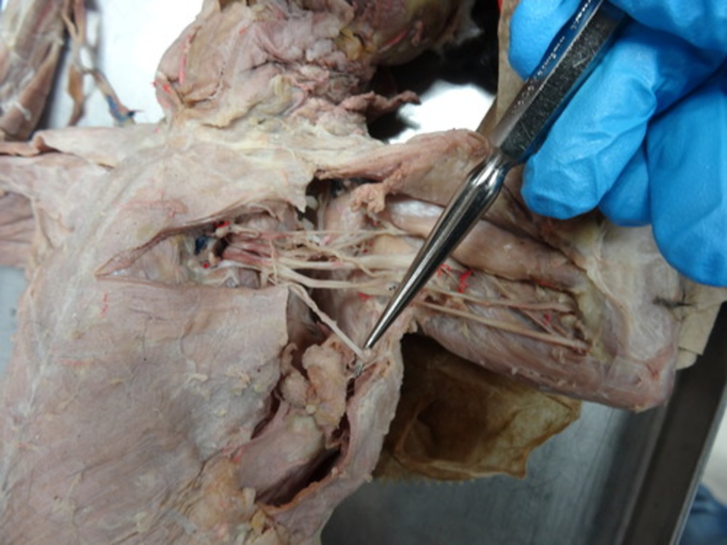 <p>1 above probe</p>