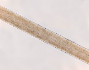 <p>Little medulla if any, or fragmented/interrupted, scaly imbricated cuticle</p>