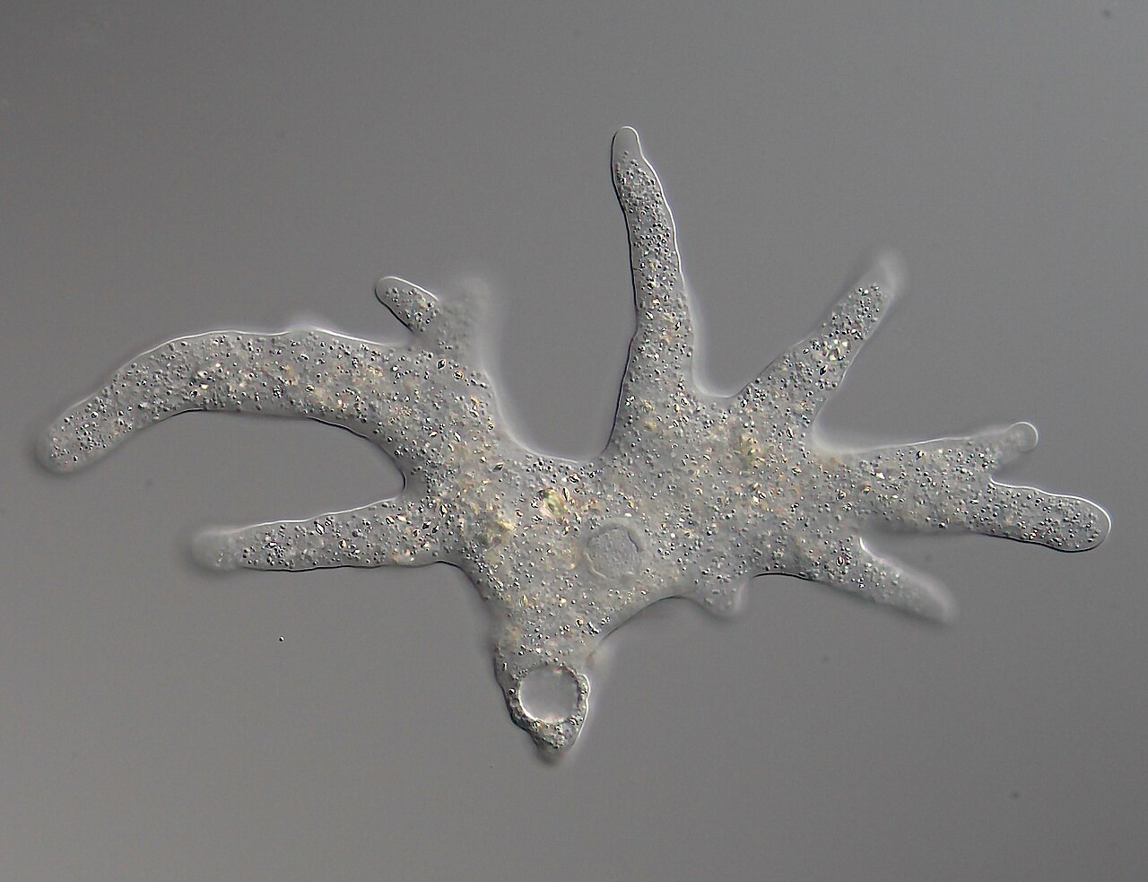 <ul><li><p>Pseudopodia</p></li><li><p>Heterotrophs</p></li><li><p>Unicellular</p></li></ul><p></p>