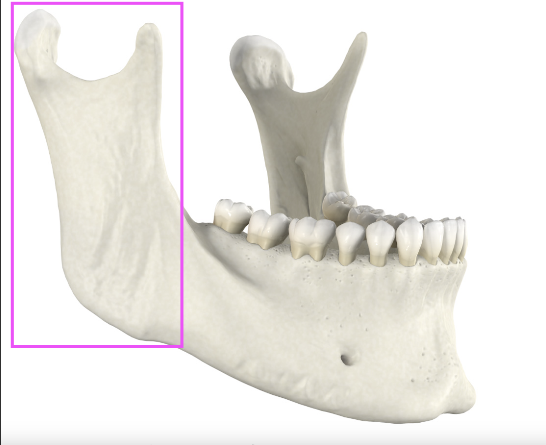 <p>What bone marking is this?</p>
