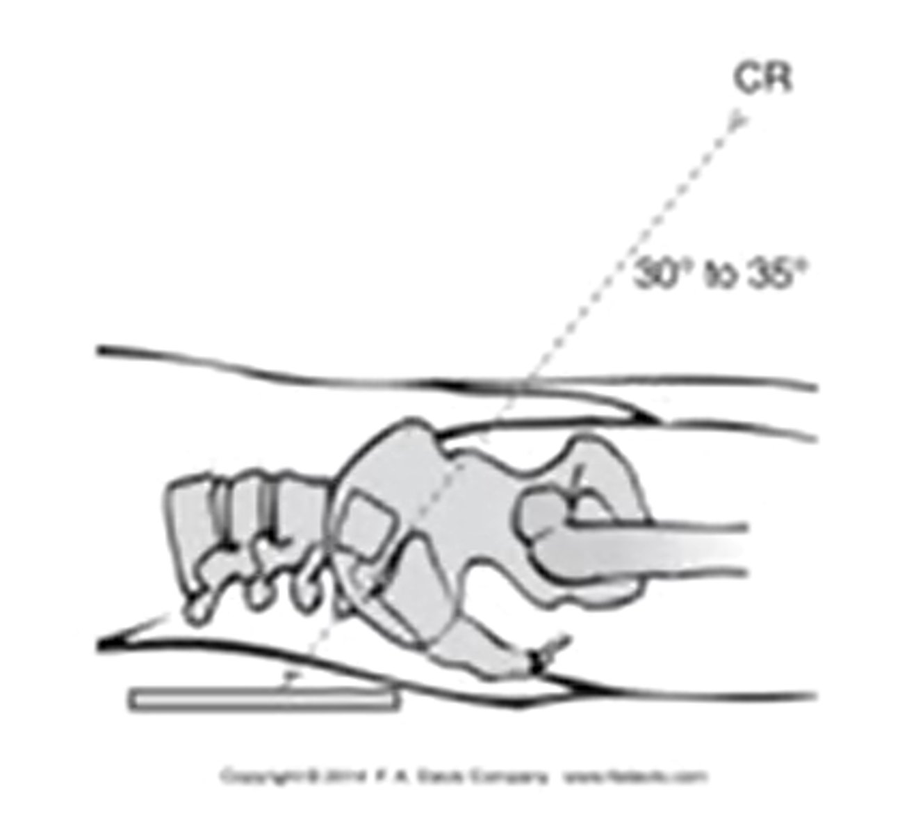 <p>inferior to superior 30-35 degrees</p>