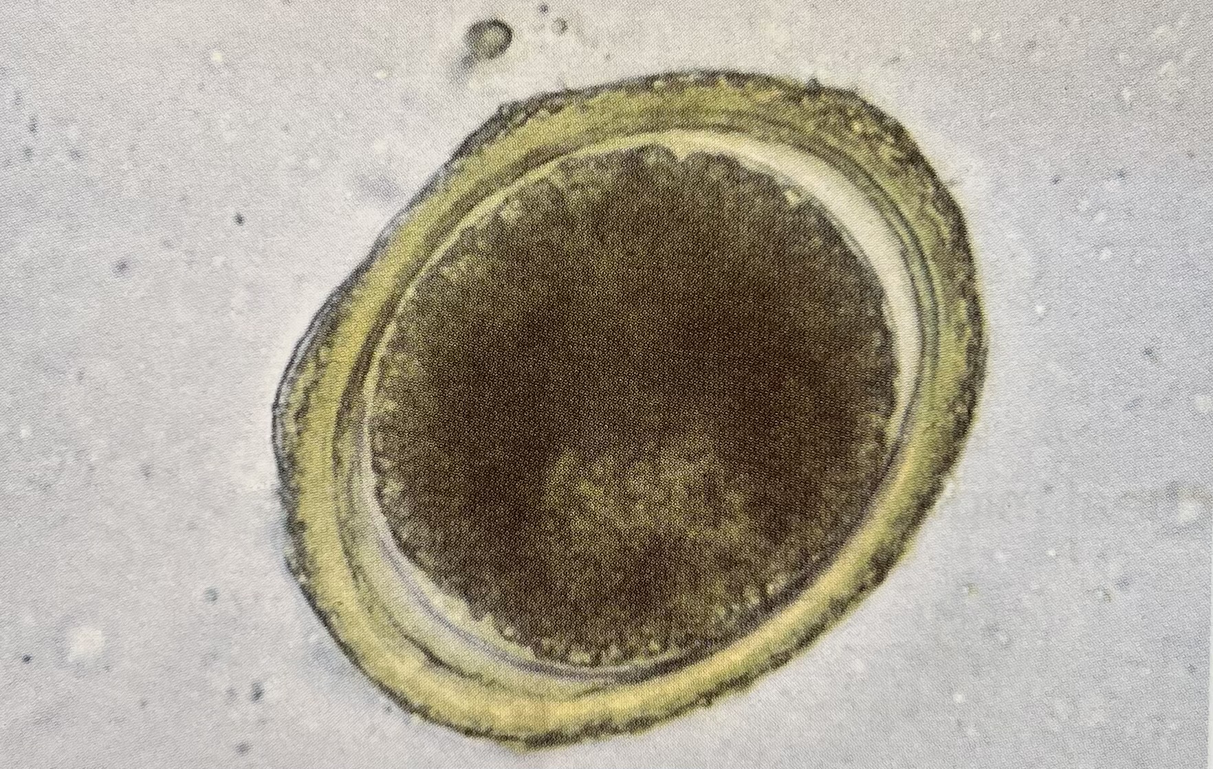 <p>What egg is this? (Bigger: 75-90um)</p>