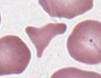 <p>pieces of red cells; variety of shapes including triangles, commas</p>