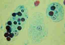 <p>měňavka (Entamoeba)</p>