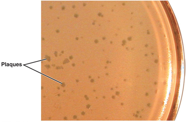 <p>plaques (bacteriophages) </p>