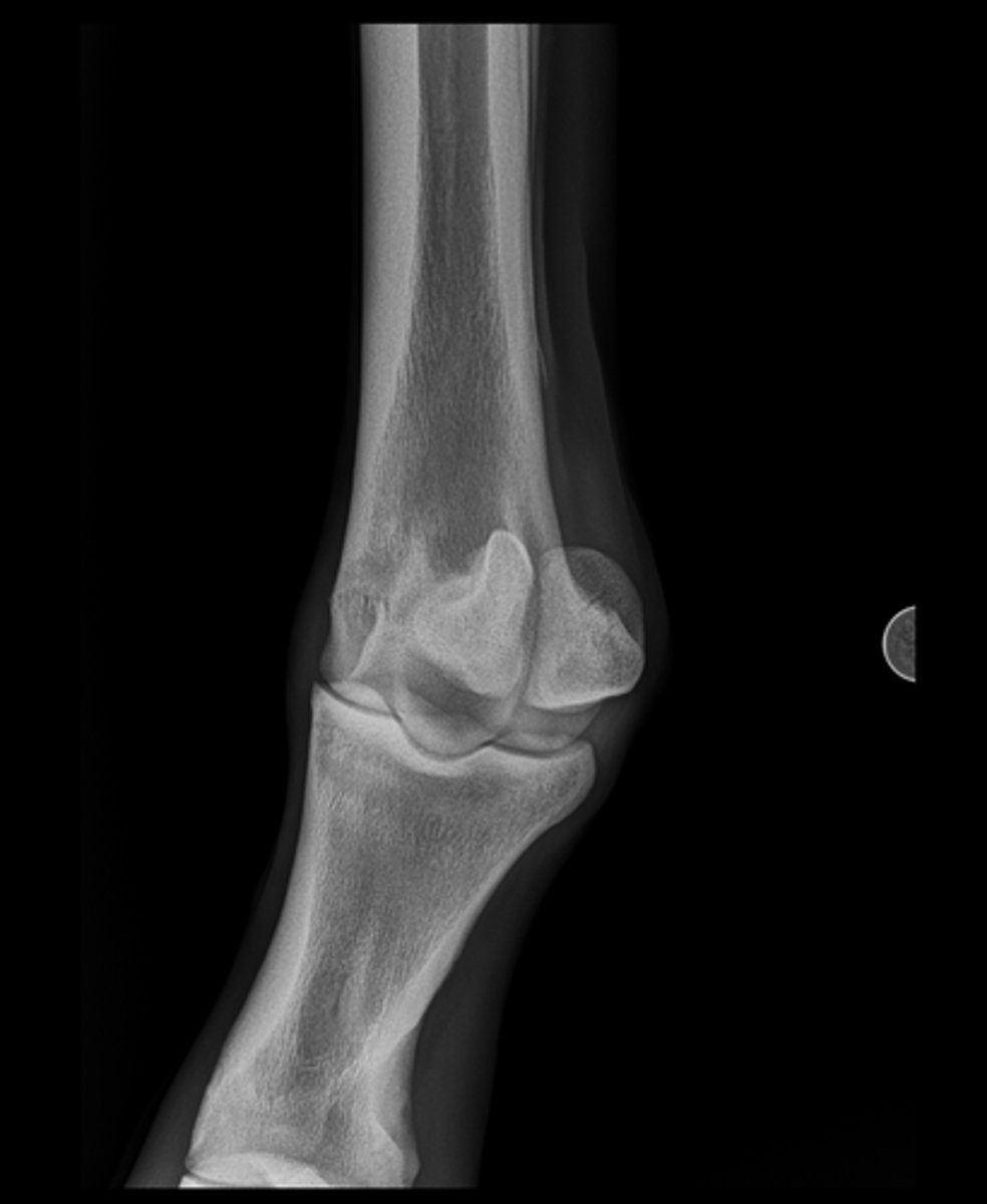 <p>Name the view and the anatomical region within the radiograph</p>