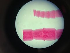<p>What is the genus species of this tapeworm? They have two common names, one being the "double pored tapeworm"</p>