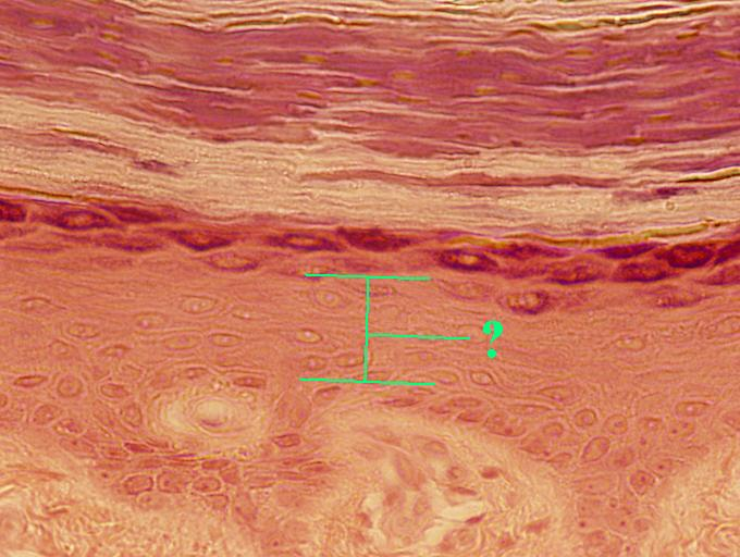 <p>stratum spinosum</p>