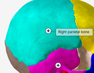 <p>What bone of the skull is this?*FREE ANSWER</p>
