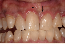 <p>Describe the tissue contour in this image?</p>