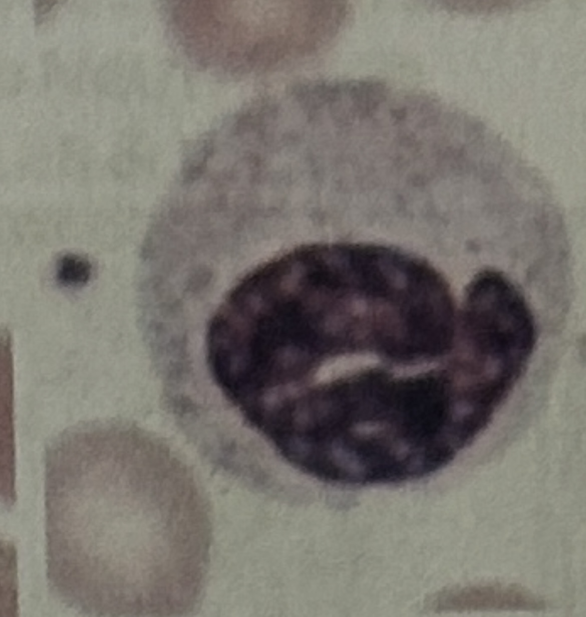 <p>WBC</p>