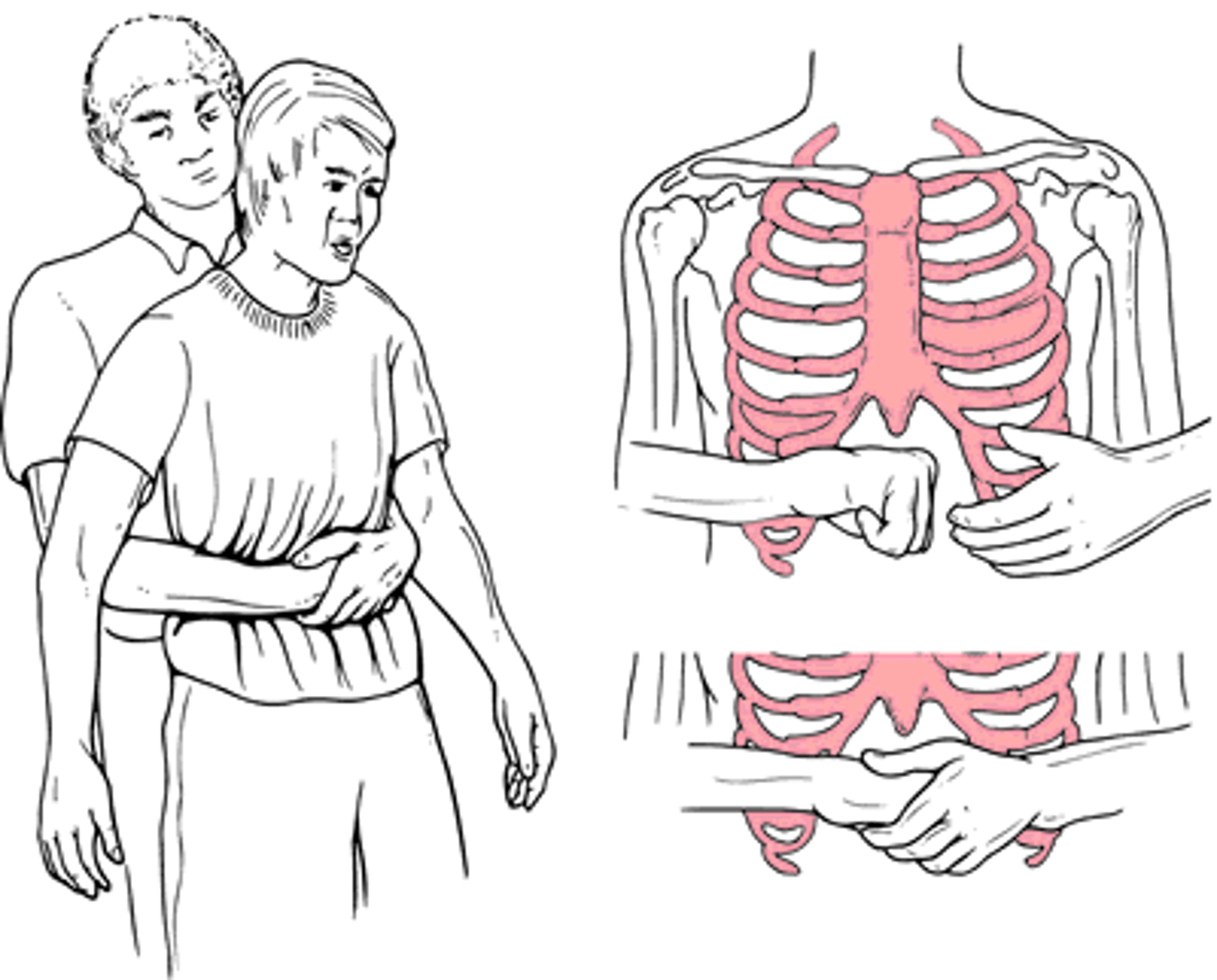 <p>1. stand or kneel behind the person.</p><p>2. wrap your arms around the person's waist and place your fist just above the belly button</p><p>3. cover your fist w/ your other hand and give up to 5 quick, inward and upward thrusts.</p>