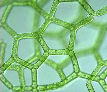 <ul><li><p>chlorophyta </p></li><li><p>non-motile, colonial </p></li><li><p>multinucleate cells, separated by cross walls</p></li></ul>