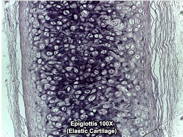 <p>epiglottis</p>