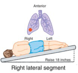 <p>What CPT position is pictured, and when is it used?</p>