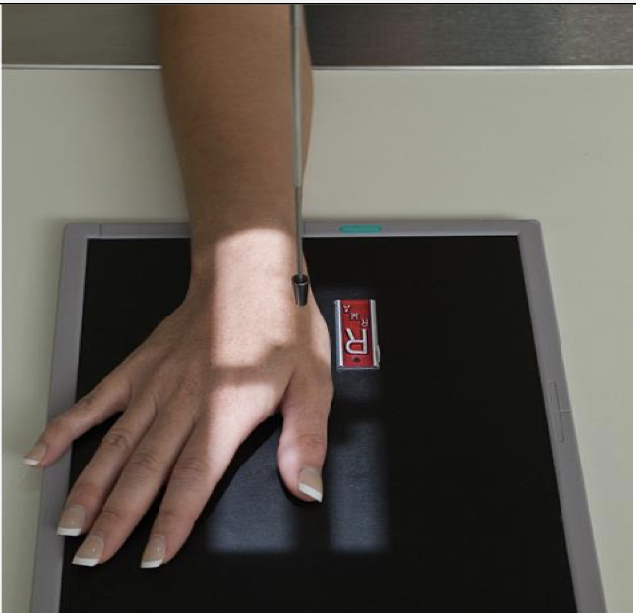<p>Patient Position</p><ul><li><p><span style="line-height: normal;"> </span>Same as AP thumb or same as finger</p></li><li><p class="p1"><span style="line-height: normal;"> </span>Sitting facing table or alongside table</p></li></ul><p class="p1">Part Position</p><ul><li><p class="p1"><span style="line-height: normal;"> </span>Hand is placed palm down on the IR (pronated)</p></li><li><p class="p1"><span style="line-height: normal;"> </span>This naturally places the thumb in a 45<span style="line-height: normal;"> o </span>oblique</p></li><li><p class="p1"><span style="line-height: normal;"> </span>Hand must be flat with no flexion in the fingers</p></li><li><p class="p1"><span style="line-height: normal;"> </span>Thumb is slightly abducted</p></li></ul><p class="p1">CR</p><ul><li><p class="p1">CR is perpendicular to 1<span style="line-height: normal;">st </span>MCP joint</p></li></ul><p class="p1">Collimation</p><ul><li><p class="p1">Collimate to include all of thumb and trapezium</p></li></ul><p></p>